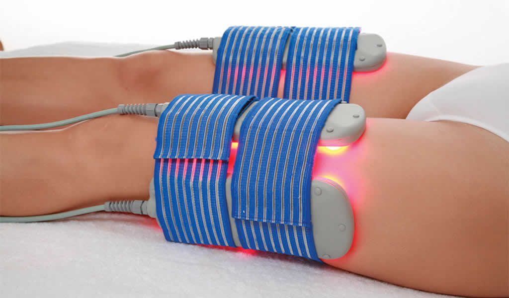 Lipoláser SLIM, aparatología estética, remodela tu figura Medical Group