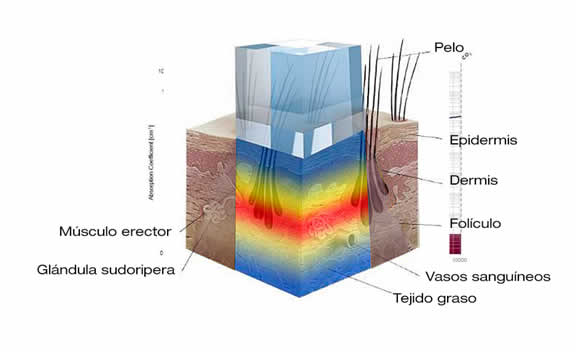 three-waves-system-superficie